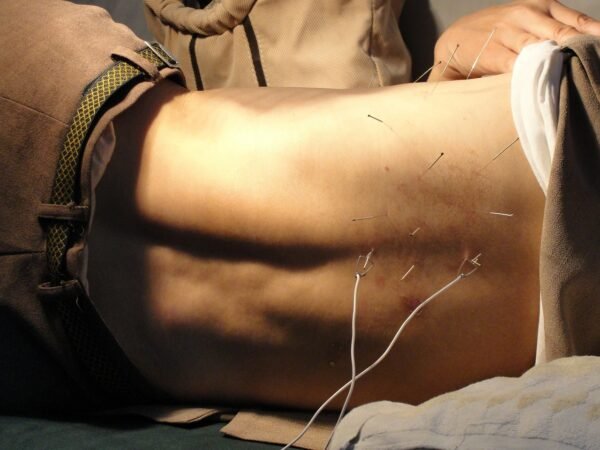 10 Akupunktur Behandlinger Klippekor